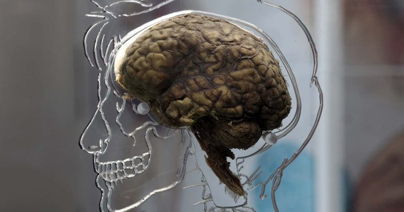 High brain activity linked to decreased lifespan: study