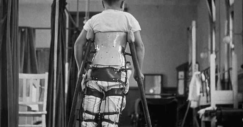 Scientists identify virus behind polio-like illness AFM which causes paralysis in children