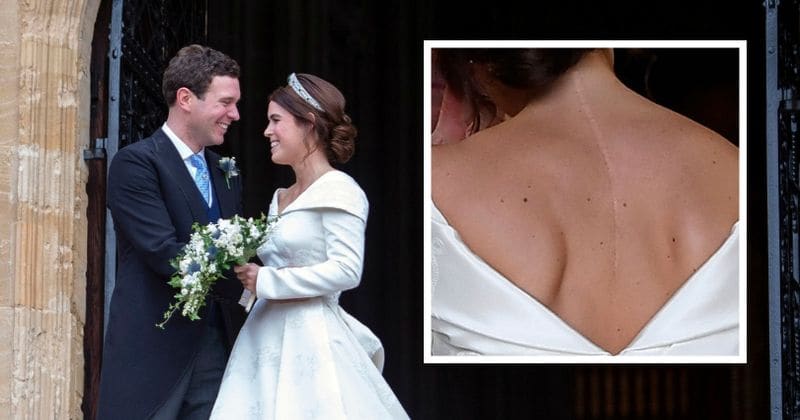 Princess Eugenie breaks age-old tradition and skips the veil to show off scoliosis scar and recognize doctors who performed life-changing surgery