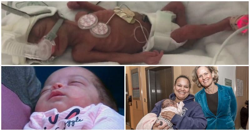 'Miracle baby' who weighed 1 lb when she was born at 25 weeks discharged from hospital