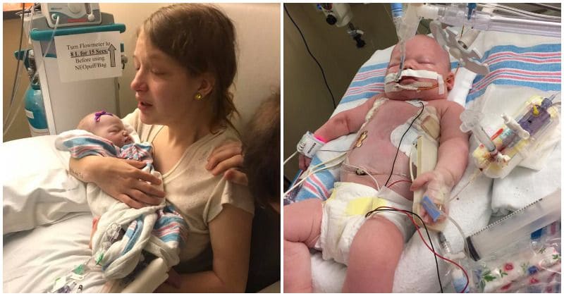 Mother distraught as eight-day-old daughter dies after contracting herpes virus from a kiss