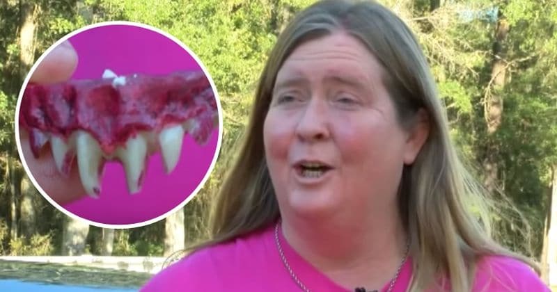Woman undergoes emergency procedure after 'devil teeth' Halloween prop gets stuck to her teeth