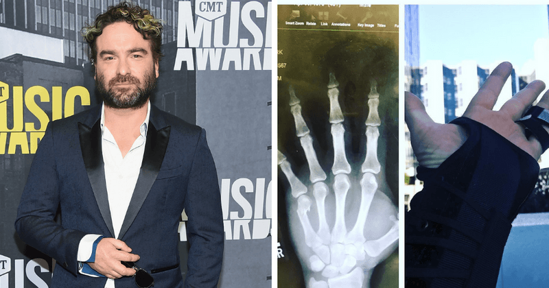 'The Big Bang Theory' star Johnny Galecki suffers hand injury and fans wonder who the other guy in the scuffle could be