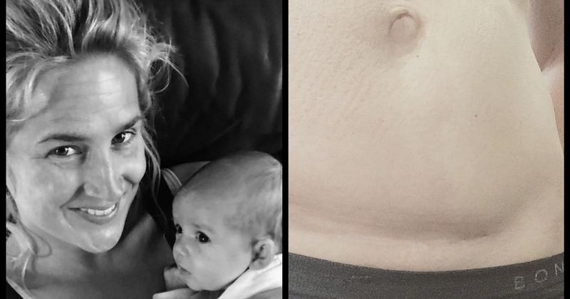 Mothers share pics of their post-partum tummies after blogger's picture of her scars removed from Instagram