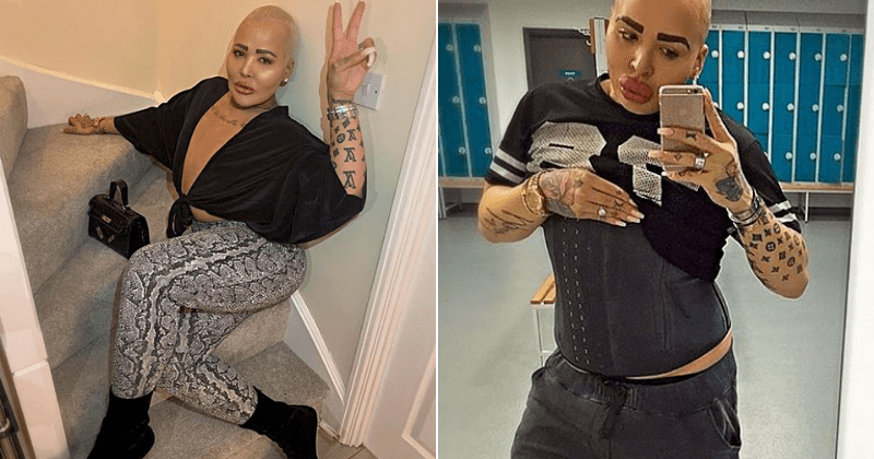 Man obsessed with Kim Kardashian undergoes two surgeries to get a butt just like his favorite star