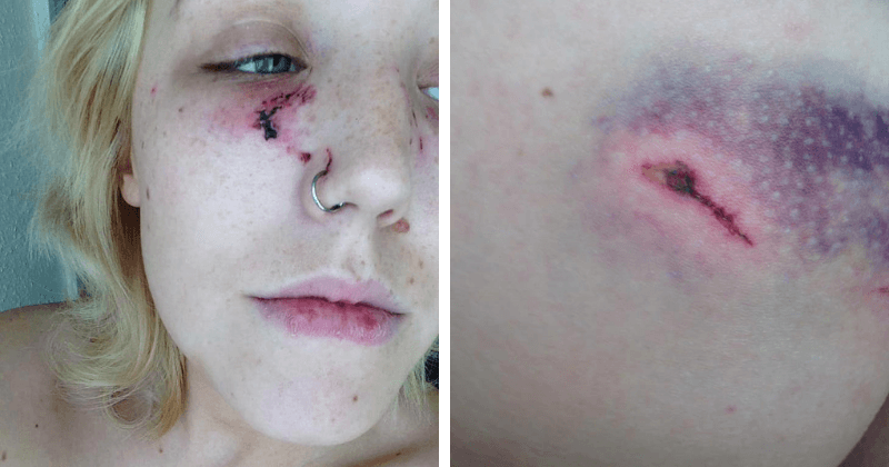 Man viciously attacks his four-weeks pregnant ex-girlfriend, leaving her with cut face and burst eardrum