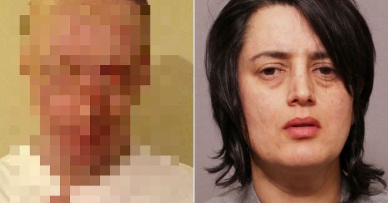 Man left blind, badly disfigured after girlfriend pours half a litre of acid on him while he was sleeping