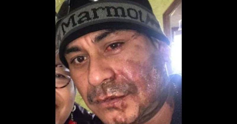 Wisconsin man suffers 2nd-degree burns from battery acid in racist attack, accused of being in country illegally