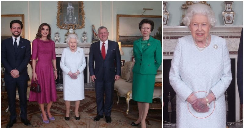 Queen Elizabeth's bruised 'purple' hand leaves public worried about the monarch's wellbeing