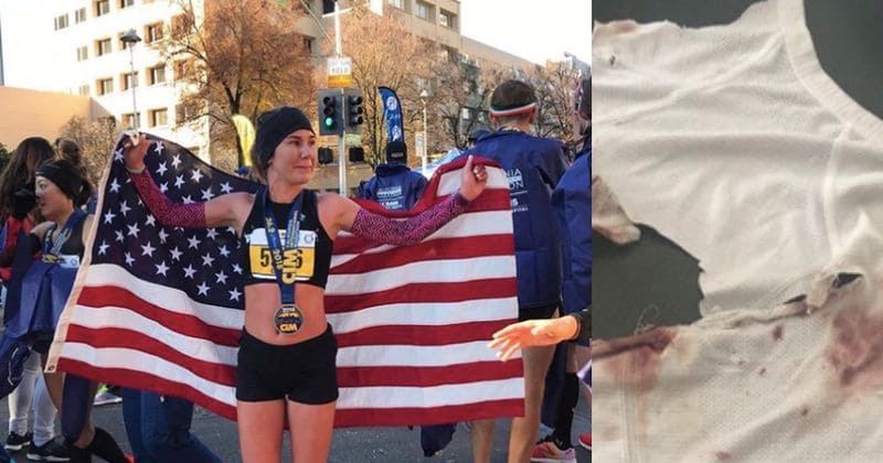 Athlete training for Olympic trials attacked by pit bull mix, suffers multiple gruesome bites