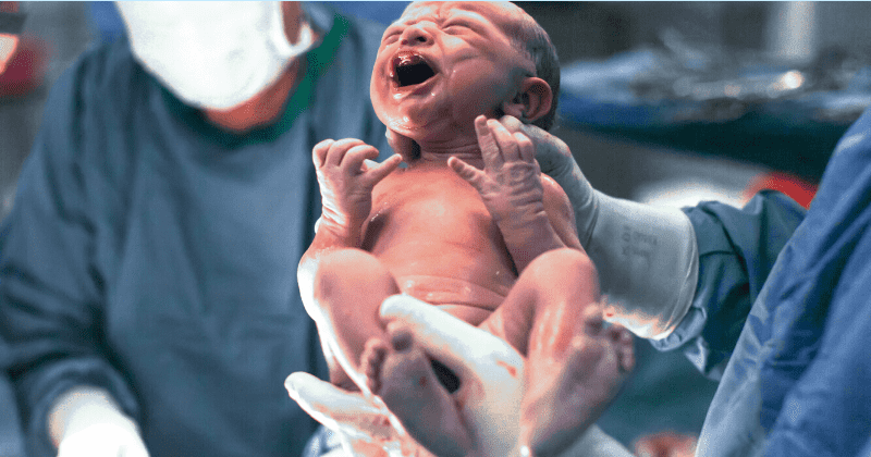 Children born by C-section not at increased risk of developing obesity, finds study which debunks notions about such an association