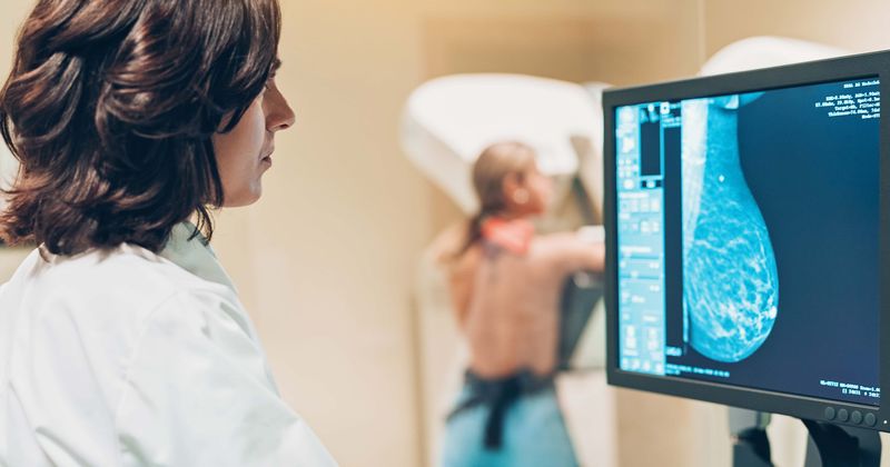 AI outperforms humans, spots breast cancer in mammograms more accurately than doctors