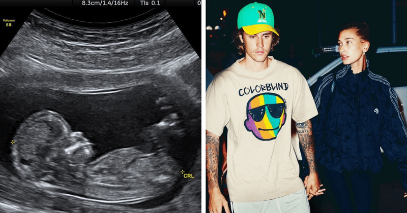 Justin Bieber proves he's quite the prankster after posting ultrasound scan as April Fool's joke