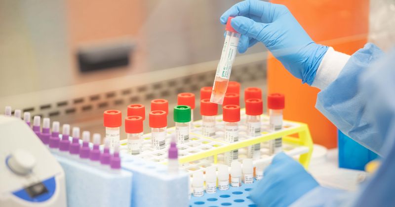 Burglar steals 29 coronavirus testing kits from Tucson Health Centre after posing as delivery man