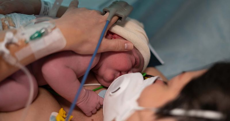 C-section may put mothers with Covid-19 at higher risk of developing complications: Study