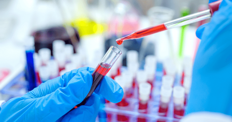 Is there an AIDS vaccine? Trump may think it exists, but here's a look at the actual status of the vaccine