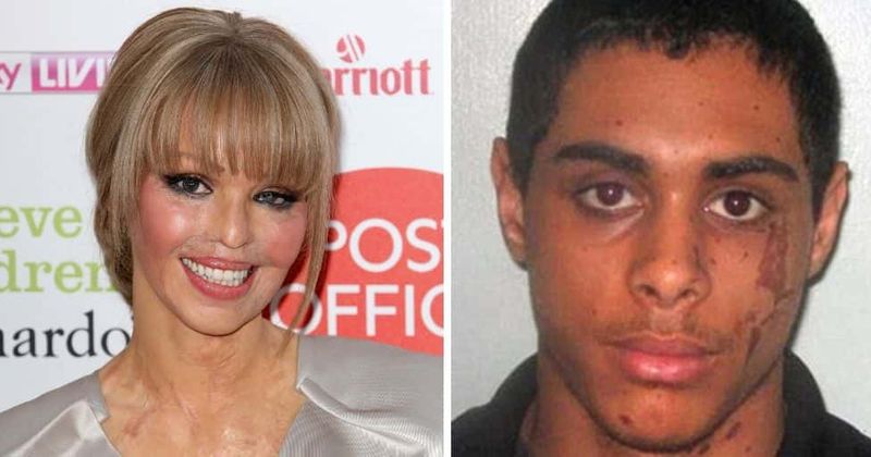 Katie Piper's acid attacker Stefan Sylvestre set to be released from prison for the second time in two years