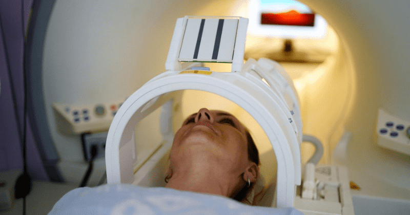 Women smokers 4 times more likely to have bulge in brain's blood vessel, high BP increases risk 7-fold: Study