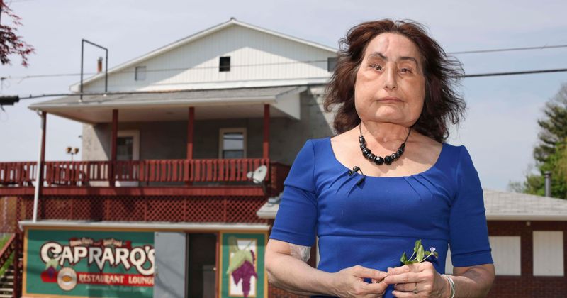 The tragedy of Connie Culp: Woman who received US's first facial transplant after being shot dies aged 57
