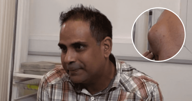 'When Skin Goes Wrong': Dr Natalia has a 'bloody procedure' as she removes huge lipoma from Shaneef's back