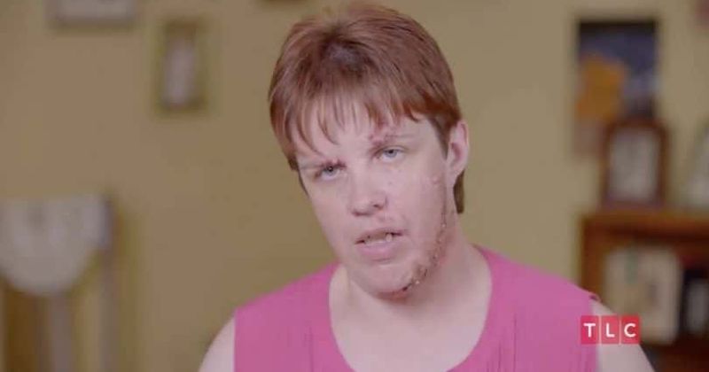 'Dr Pimple Popper': Monica tries to get rid of bumps on face and neck tired of being mocked for 'Halloween' look