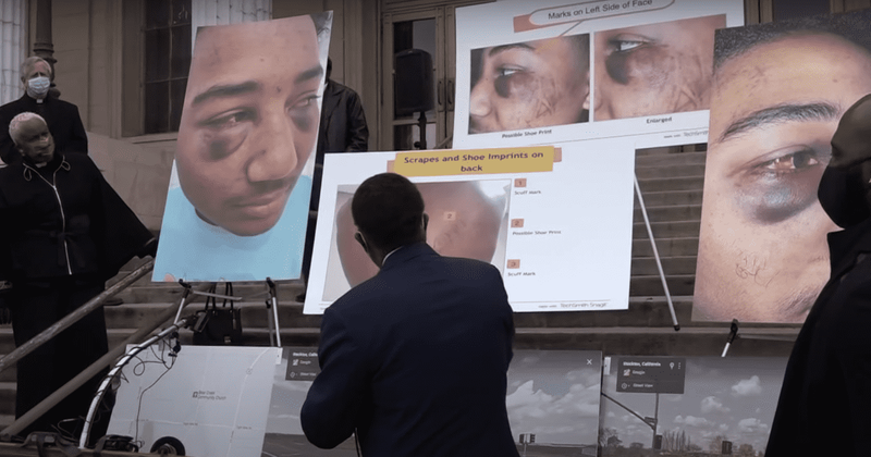 Who is Devin Carter? California cops attacked Black teen, 17, like a 'pack of wolves', claims lawsuit