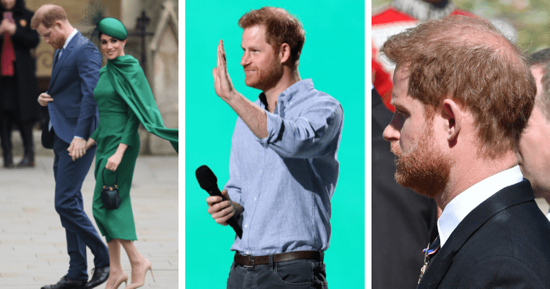 Is stress of moving to US making Prince Harry go bald? Doc's shocking insight