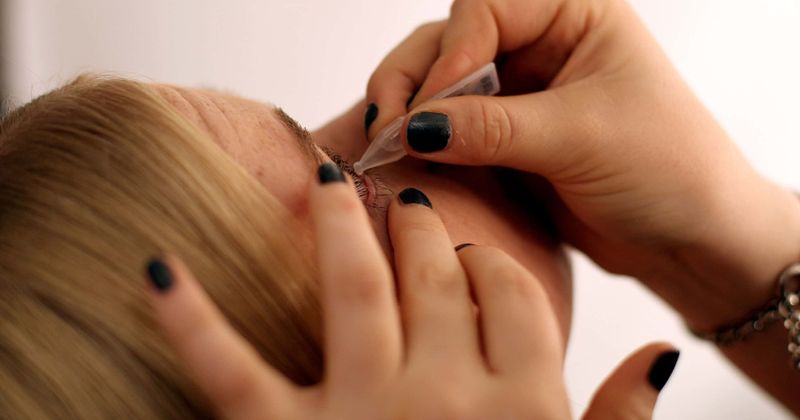 Mom of three, 35, seals eye shut after mistaking nail glue for hay fever drops