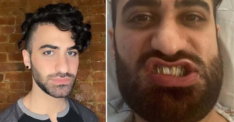 Who is Sina Rezaie? NYC doc called 'f****t', thrashed in 'hate crime' that broke his jaw