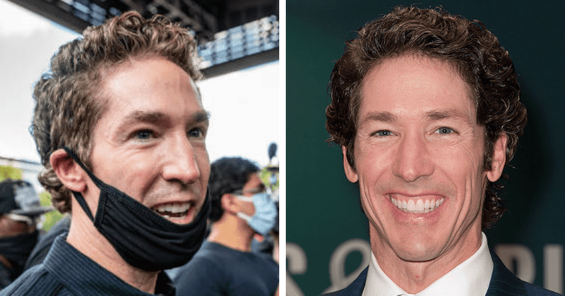 Did Joel Osteen get plastic surgery? Pastor once confirmed he wants to 'look good'