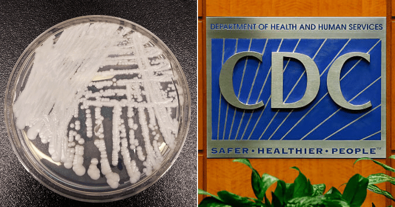 How dangerous is Candida auris 'superbug'? CDC confirms over 100 cases in DC and Texas