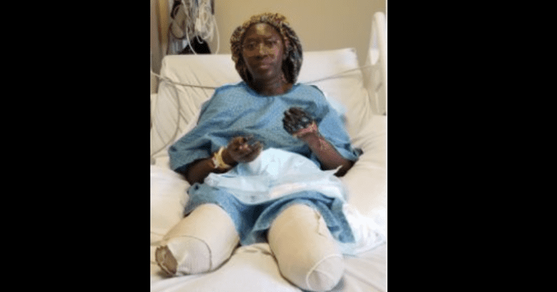 What happened to Jummai Nache? Nigerian woman's leg amputated after second dose of vaccine