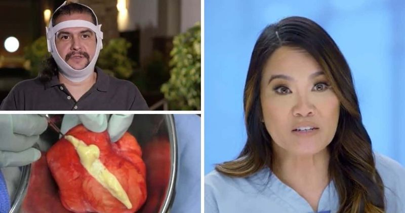 'Dr Pimple Popper': Sandra Lee likens Leonardo's head bump to 'custard with cream frosting'