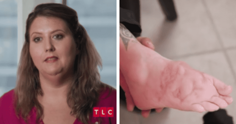 What happened to Alisha Williams' feet? A look at 'My Feet Are Killing Me' star's accident