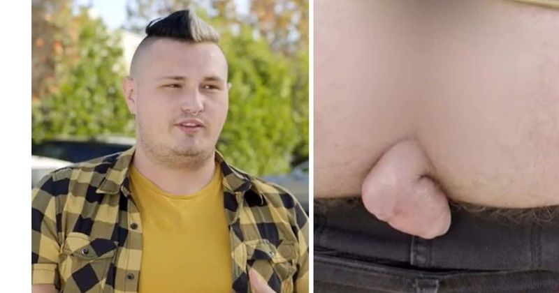 Can Dr Pimple Popper help drag queen Corey remove 'embarrassing growth' on his butt?