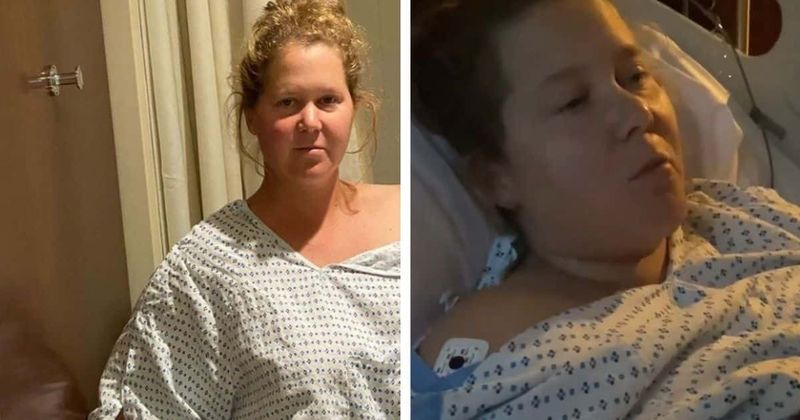 Is Amy Schumer OK? Comedian gets uterus and appendix removed in endometriosis surgery