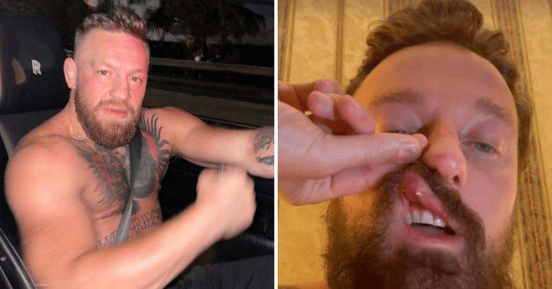 Who is Francesco Facchinetti? Italian DJ accuses Conor McGregor of breaking his nose