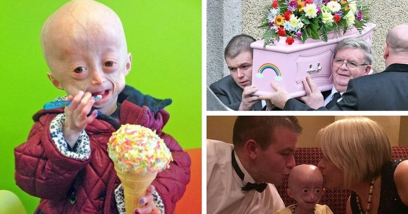 Girl who aged eight times times faster than her friends dies at the tender age of 8