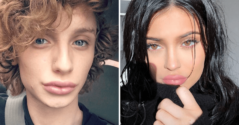 Transgender woman spends $75,000 on plastic surgery to look like her idol Kylie Jenner