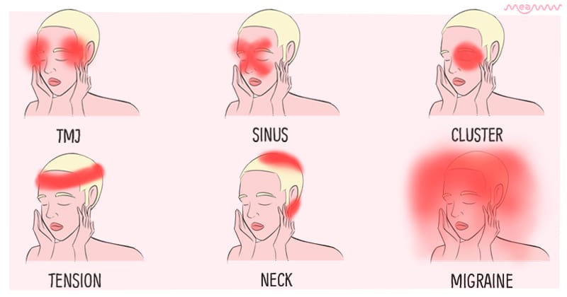 DOLOR DE CABEZA EN LA CIEN_2